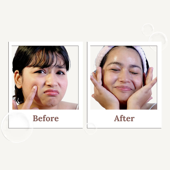 Glow Grain - Rice Enzyme Cleanser