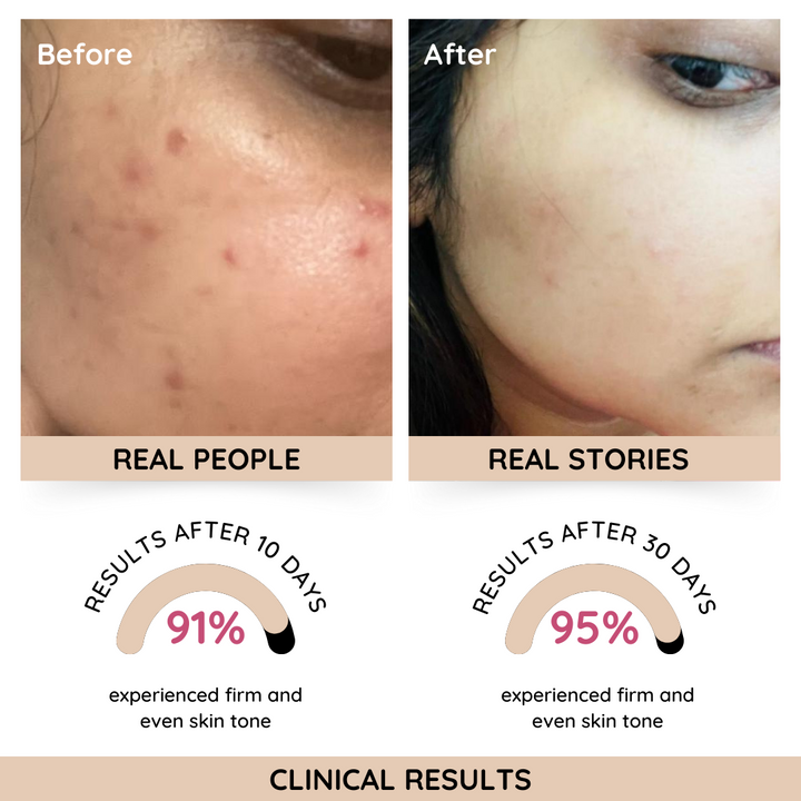 Rose Glass Skin Moisturizer - Single