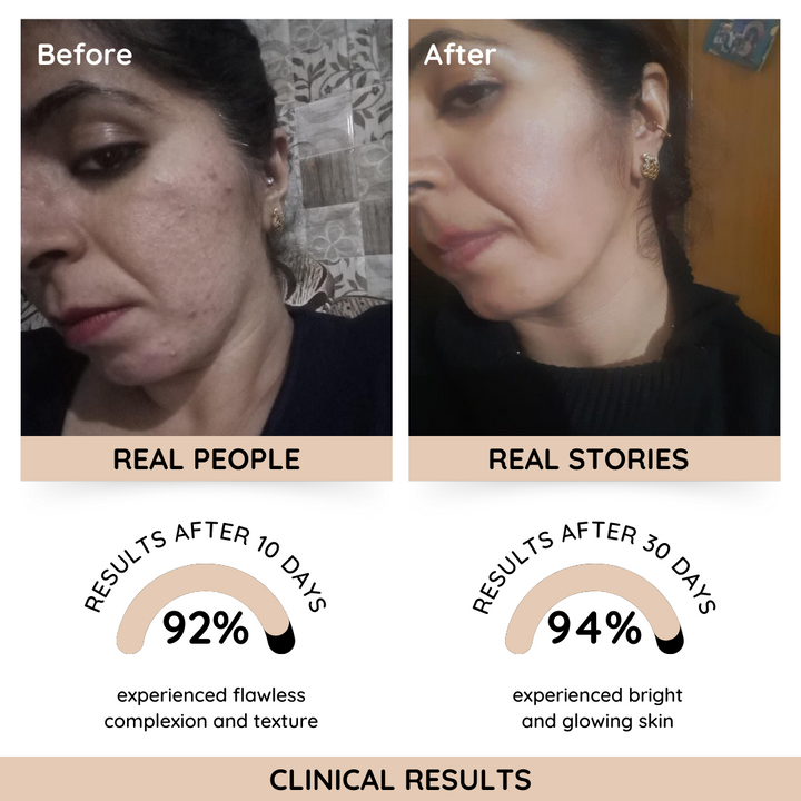 Rosanna Instant Glow Face Mask