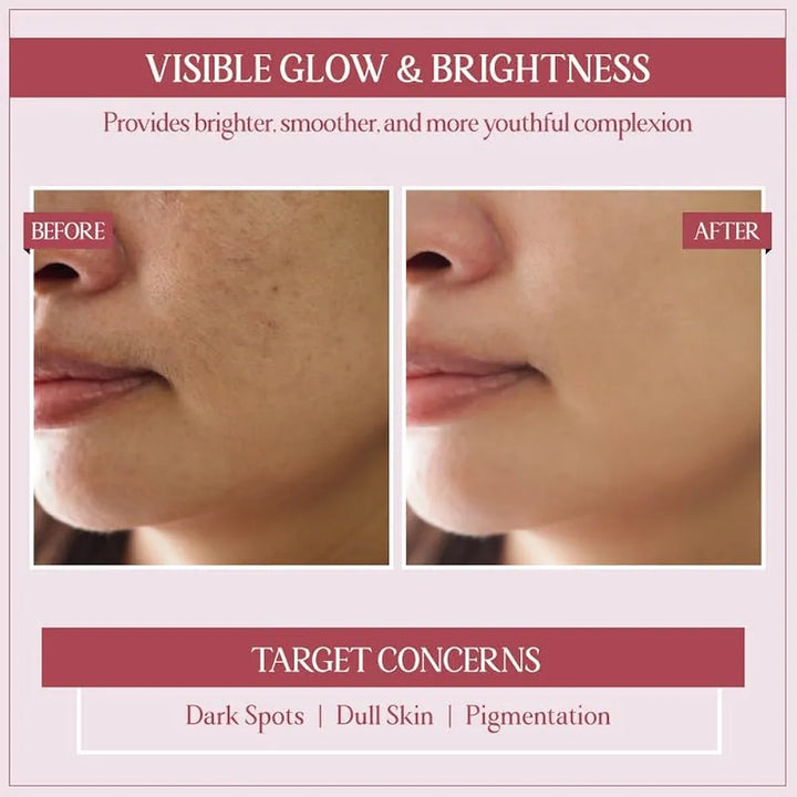 TYC - TRUST YOUR CHOICE Ayurveda Glycobright Day SPF-30 Face Cream For Bright And Glowing Skin With 1% Glycolic And Shankhapushpi, Plant Based - 50 gm 