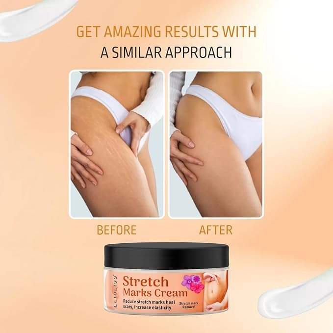 Elibliss Stretch Marks Cream - 50 gms