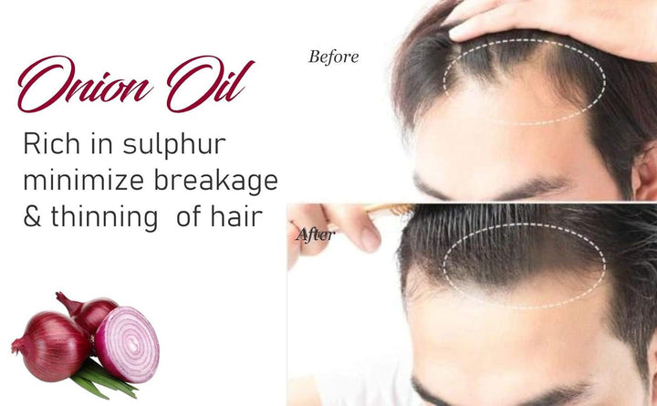 Old Tree Onion Hair Oil - 15 ml