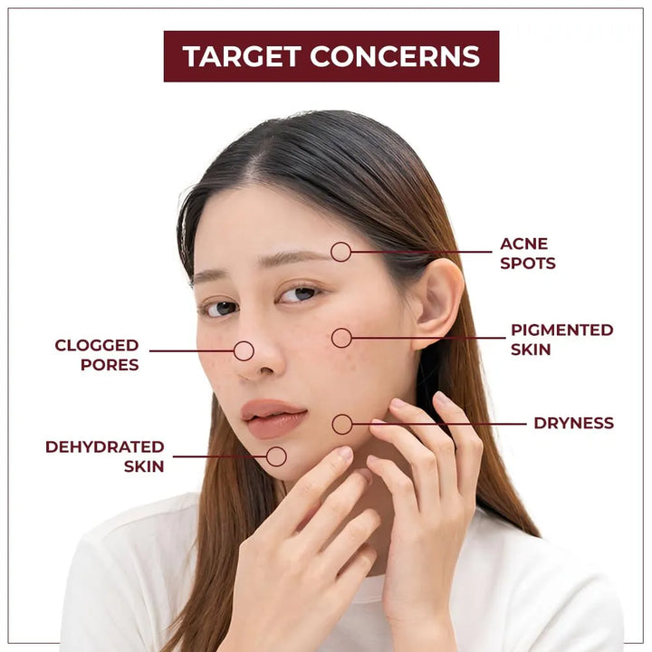 TYC - TRUST YOUR CHOICE Depigmentation Gel with 4% AHA and Papaya Enzymes, Reduces Pigmentation, Dark Spots, and Acne Marks, Glass Skin Effect, For Unisex, Pack of 1 