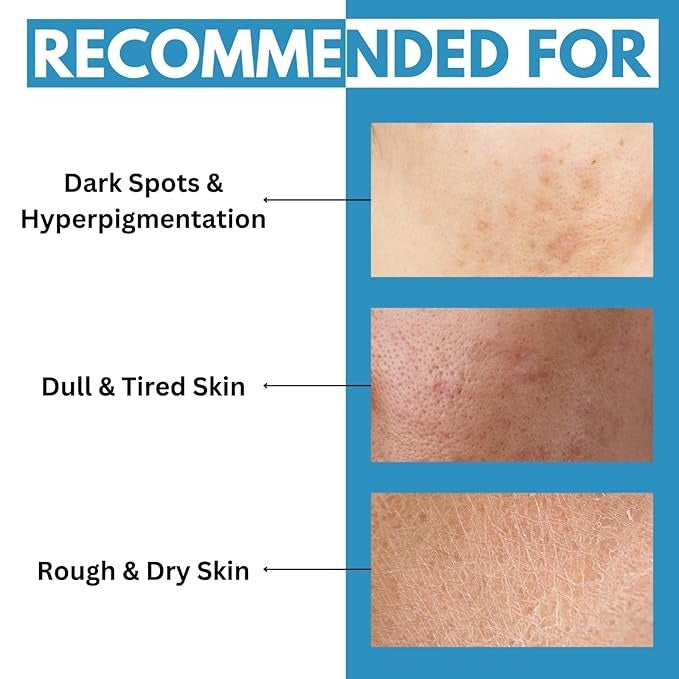 Samisha 2% Niacinamide & Rice Water Organic Face Toner - 100 ml