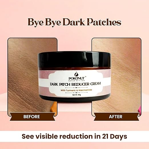 Pokonut Dark Neck and Patch Removal Cream with Turmeric - 50 gms