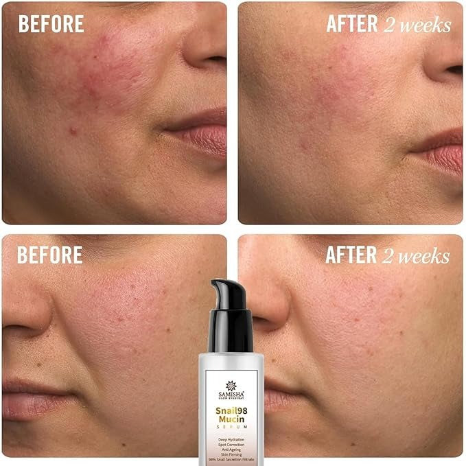 Samisha Snail Mucin Face Serum for Men and women - 100 ml