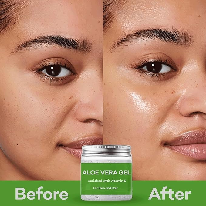 Samisha Aloe Vera Gel For Face - 200 gms