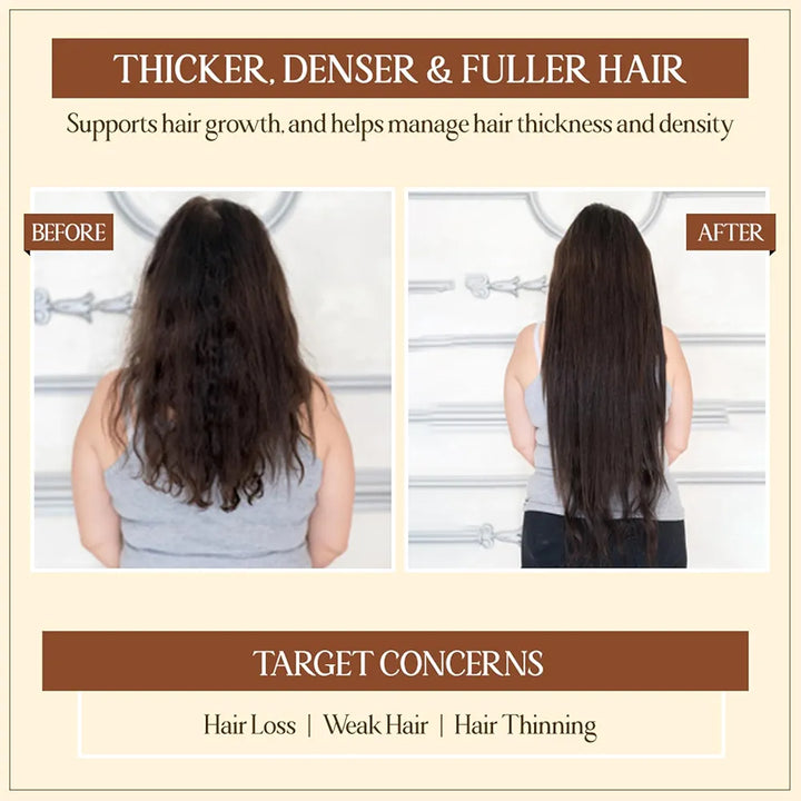 TYC - TRUST YOUR CHOICE Herbal Hair Growth Oil With 75 Herbs | Manages Hair Fall, Hair Thinning & Hair Loss | Helps In Hair Growth | Healthy & Strong Hair, 150 Grams