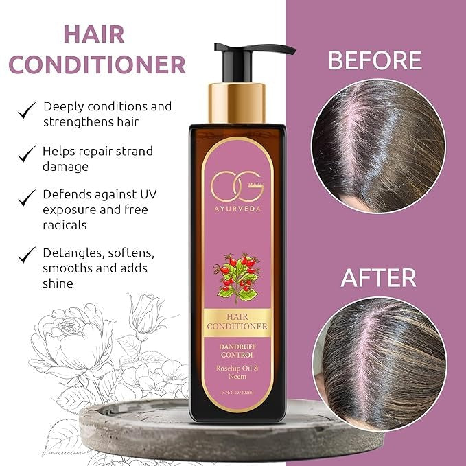 OG BEAUTY Ayurveda Dandruff Control Hair Conditioner - 200 ml