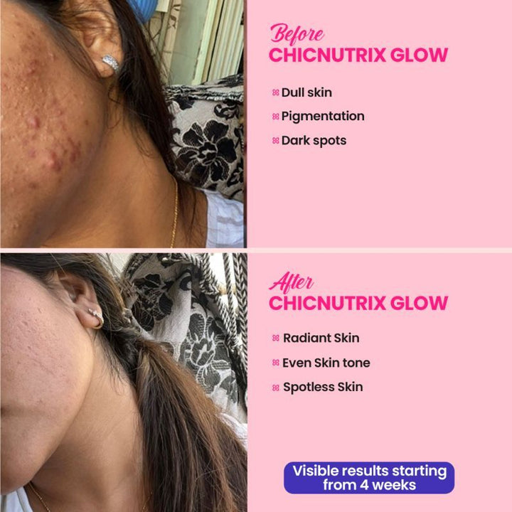 chicnutrix glow glutathione and vitamin c Chicnutrix Glow Glutathione & Vitamin C Strawberry Lemon Pack of 2