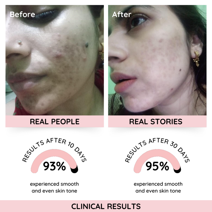 Rose Instant Glow Enzyme Scrub