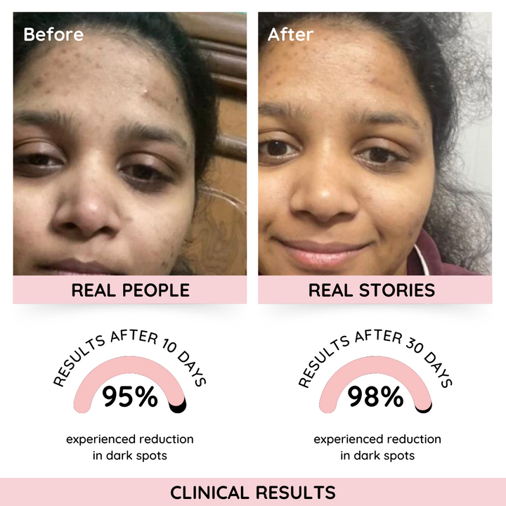 Rose Glass All-Rounder Skin Serum