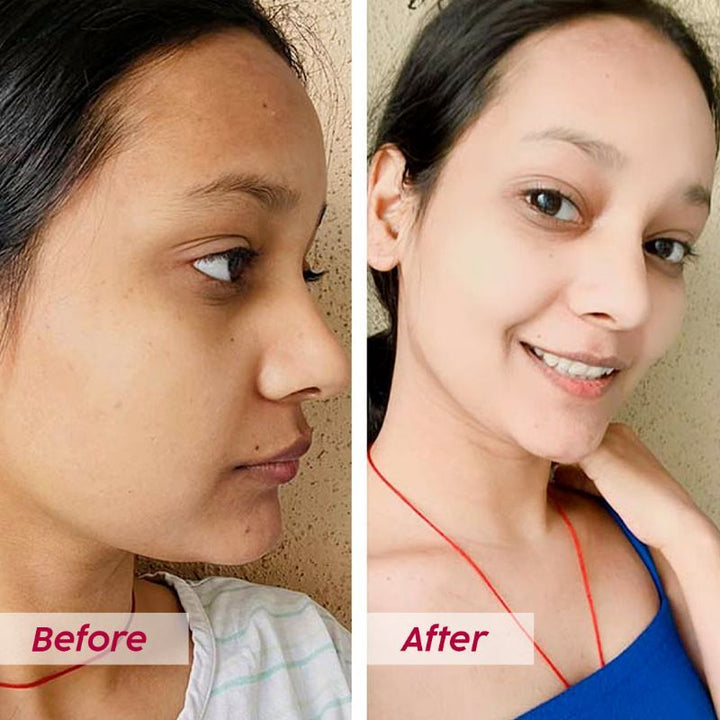 plix glutathione before and after Plix Glutathione Skin Glow Effervescent Tablet 500mg (Pack of 2)